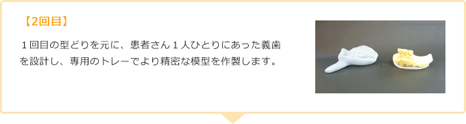 【2回目】１回目の型どりを元に、患者さん１人ひとりにあった義歯を設計し、専用のトレーでより精密な模型を作製します。