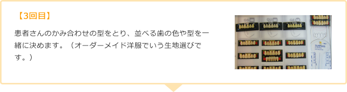 【3回目】患者さんのかみ合わせの型をとり、並べる歯の色や型を一緒に決めます。（オーダーメイド洋服でいう生地選びです。）