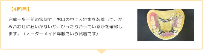 【4回目】完成一歩手前の状態で、お口の中に入れ歯を装着して、かみ合わせに狂いがないか、ぴったり合っているかを確認します。（オーダーメイド洋服でいう試着です）