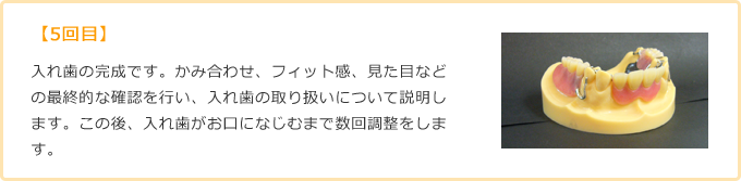 【5回目】入れ歯の完成です。かみ合わせ、フィット感、見た目などの最終的な確認を行い、入れ歯の取り扱いについて説明します。この後、入れ歯がお口になじむまで数回調整をします。